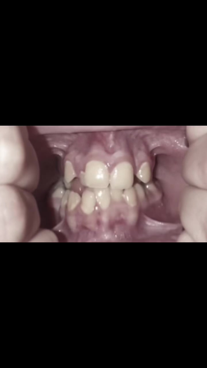 @𝐻𝒶𝓊𝓃𝓉𝑒𝒹