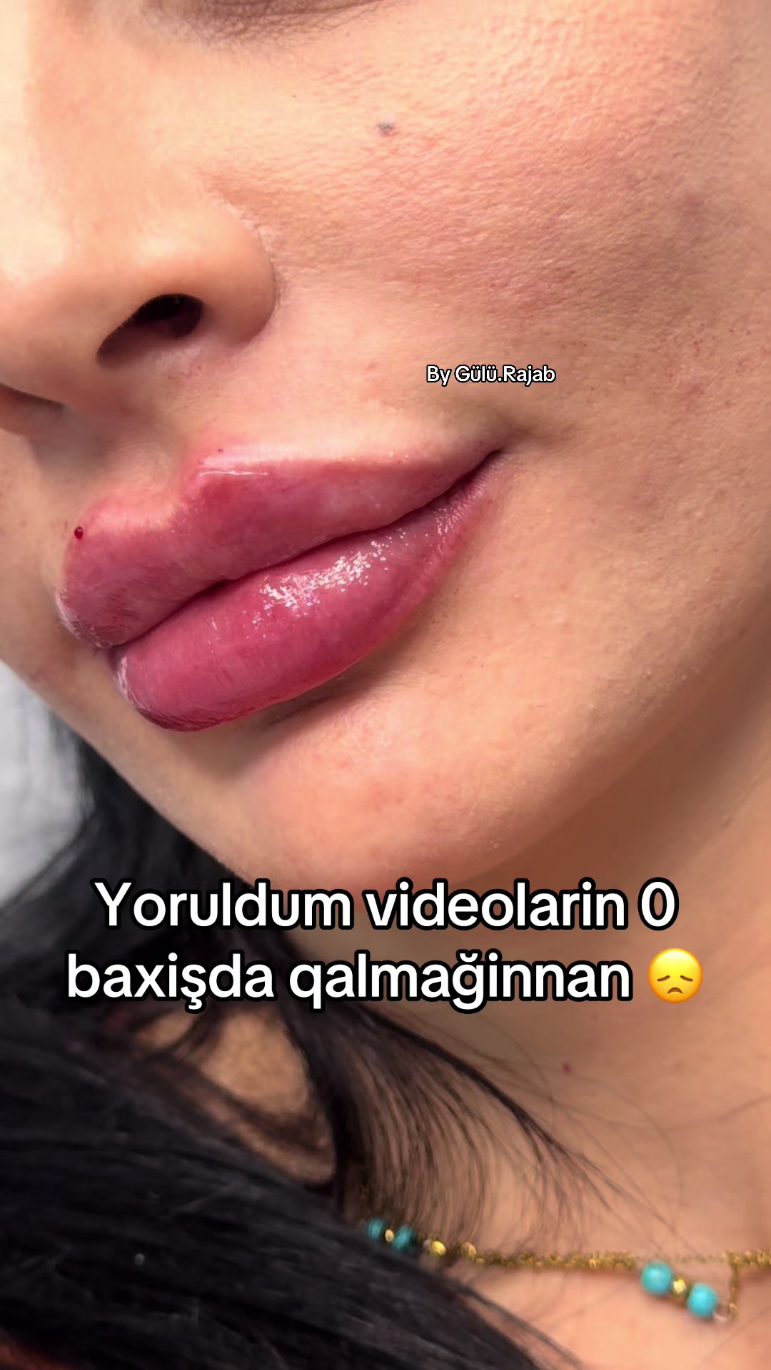 @Kosmetoloq_Gülü_Rajab
