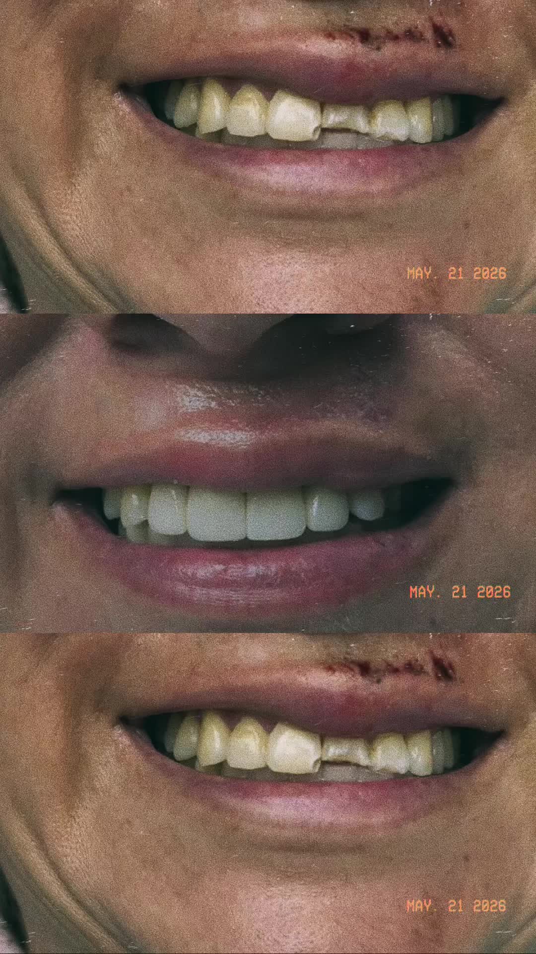 @Omega Dental