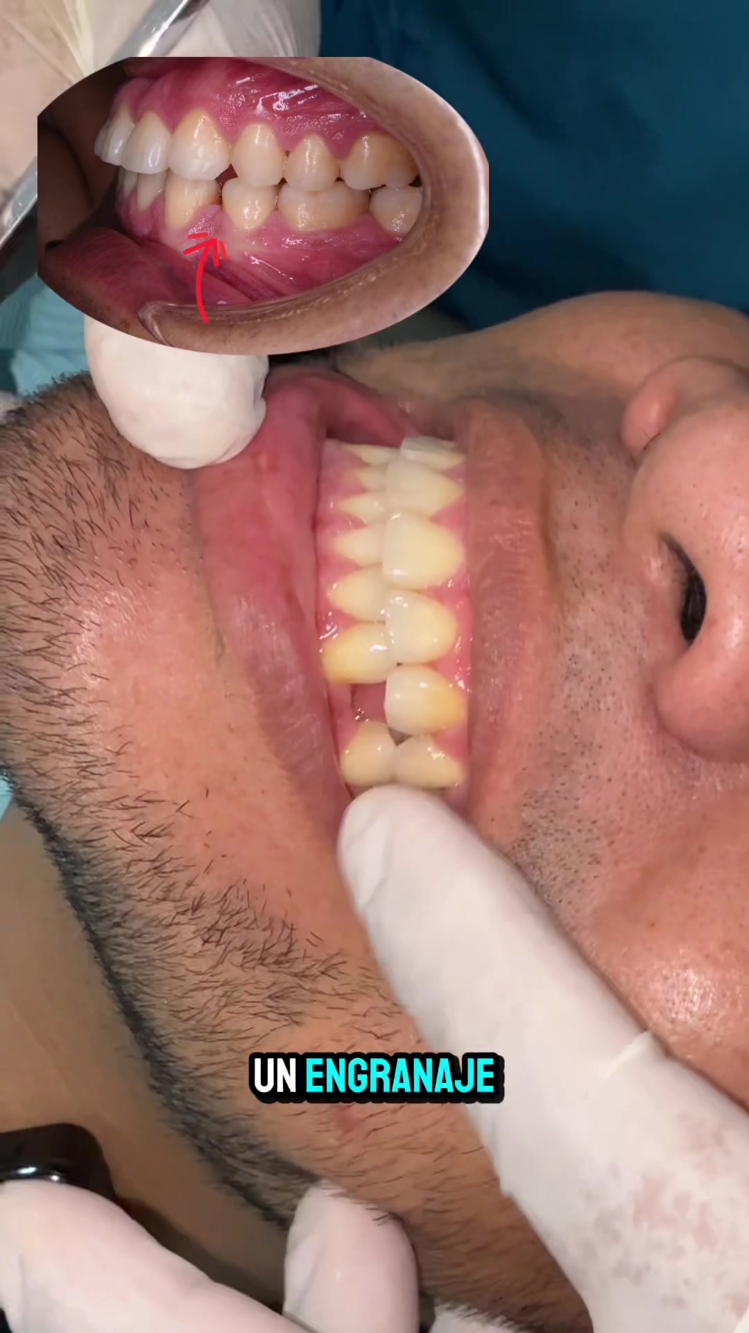 @DentikaBrackets