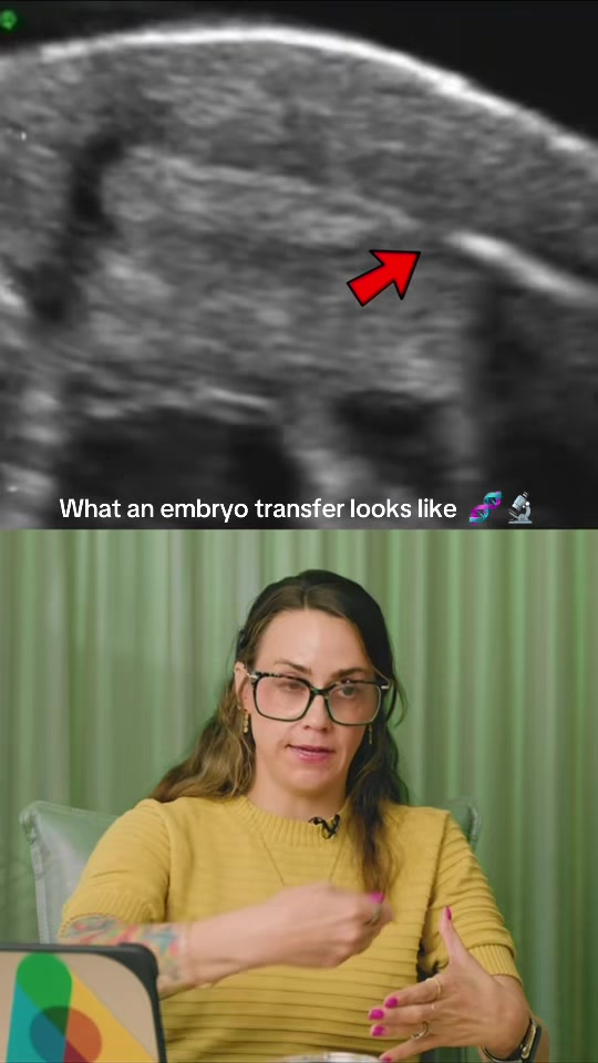 @Alcea Surrogacy