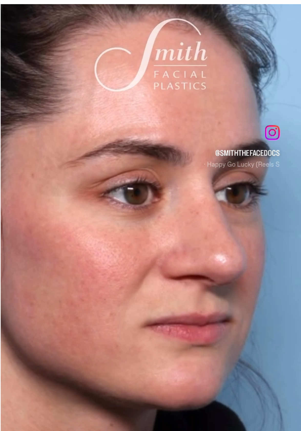 @Smith Facial Plastics