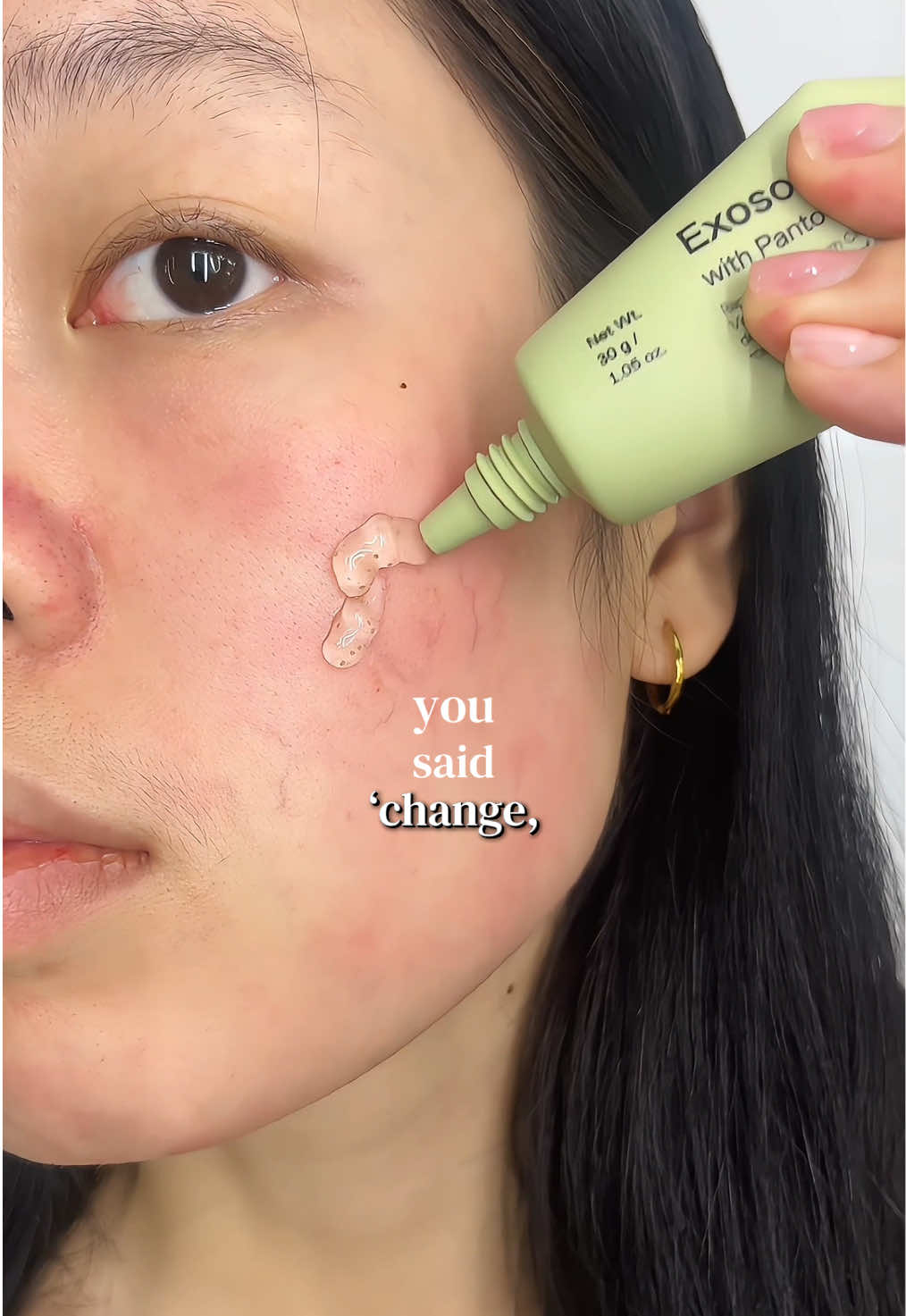@Tracyskin