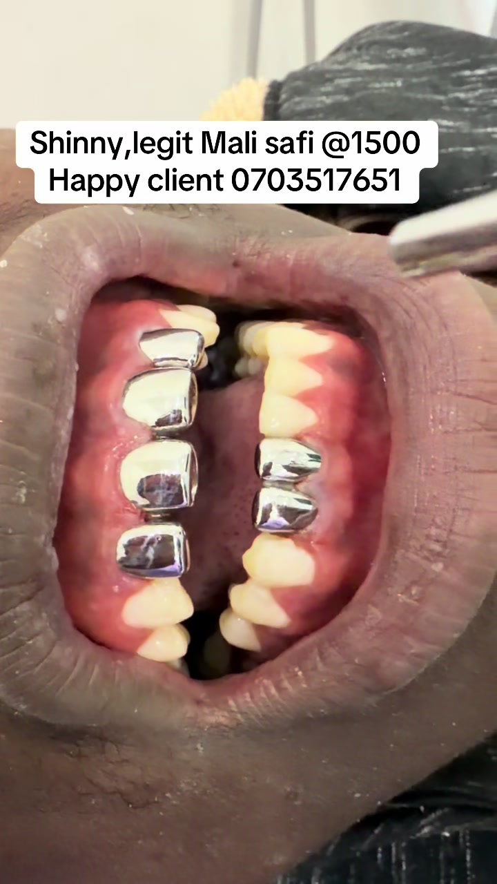 @Tiba dental care