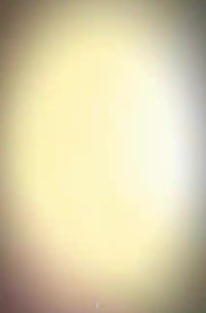 @AFFY๐ค