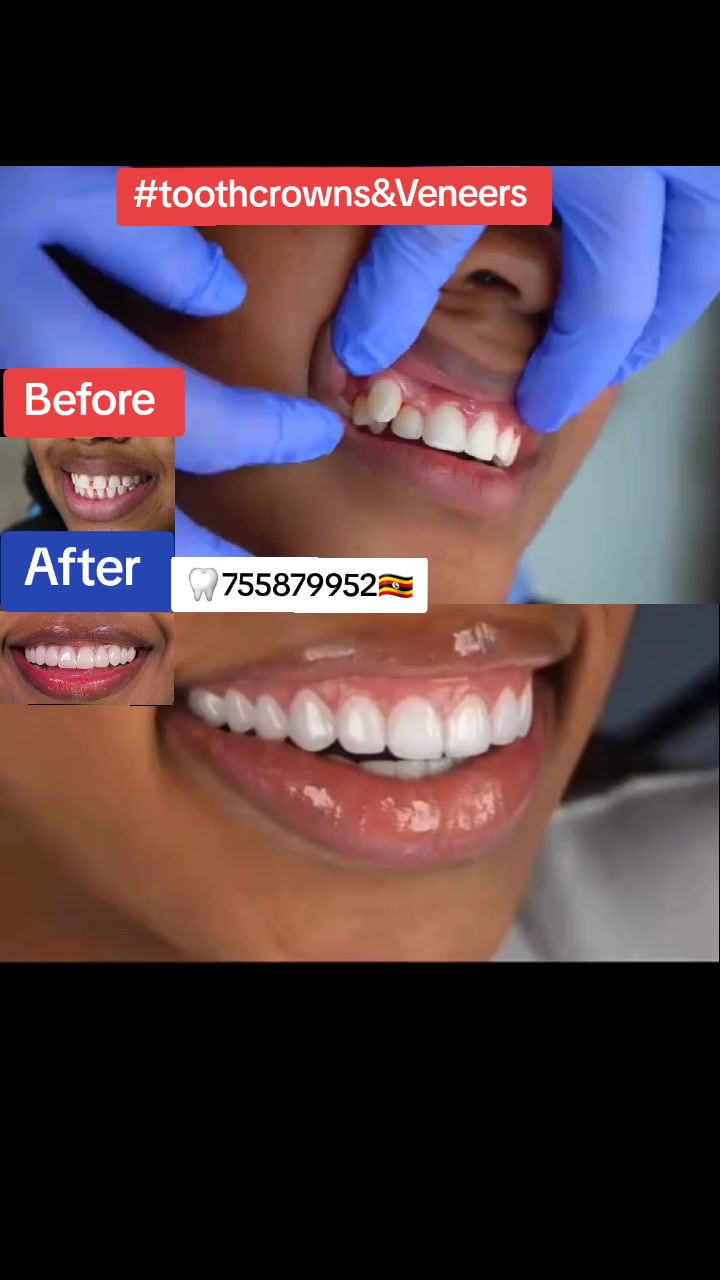 @Allianz Dental studio🦷🦷🇺🇬