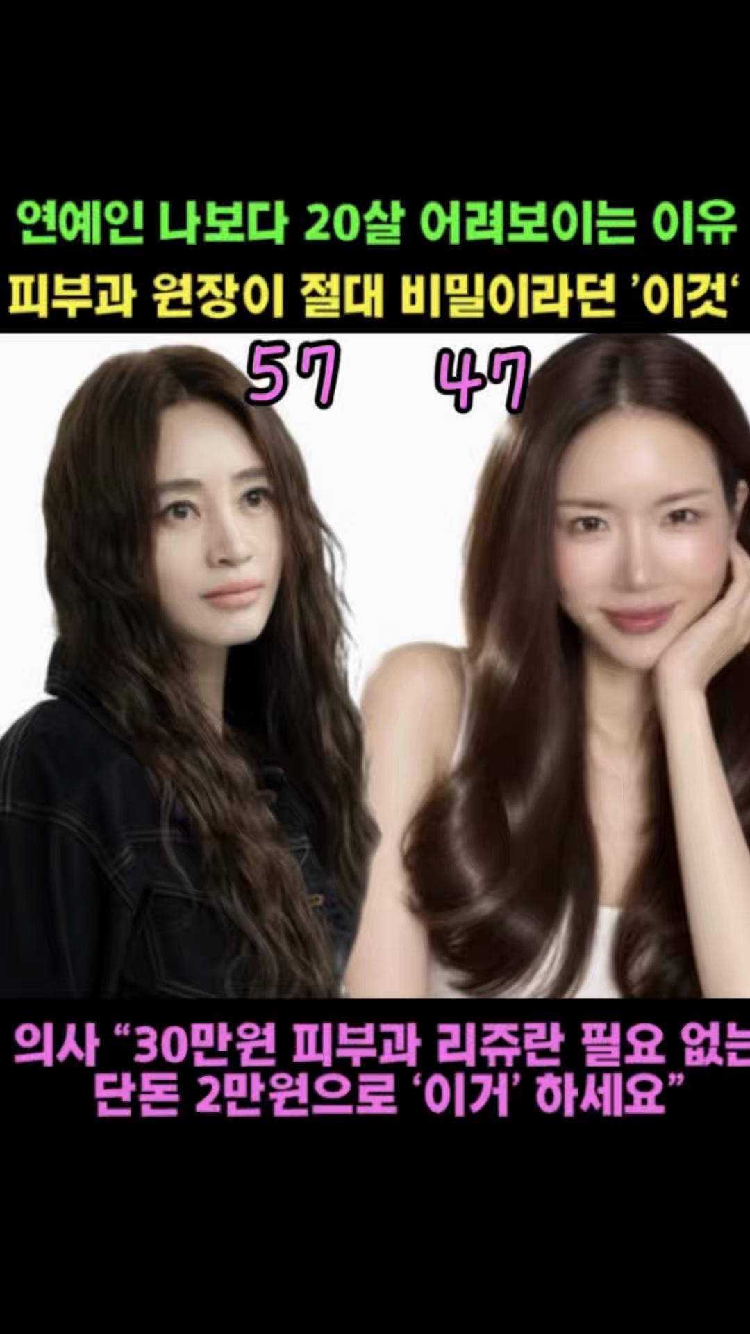 @지나스 GINAS