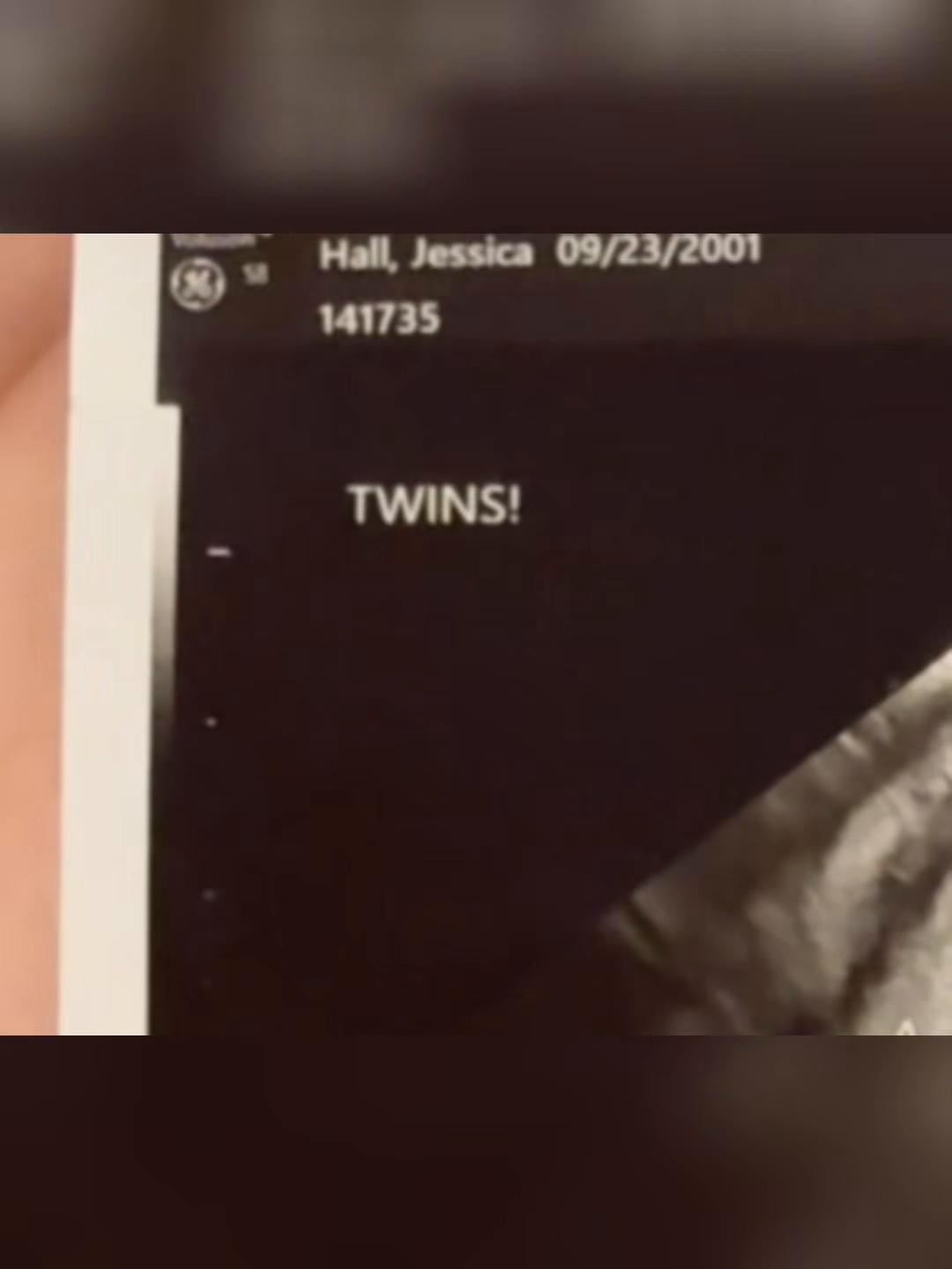 @Jessticles 💕🥰