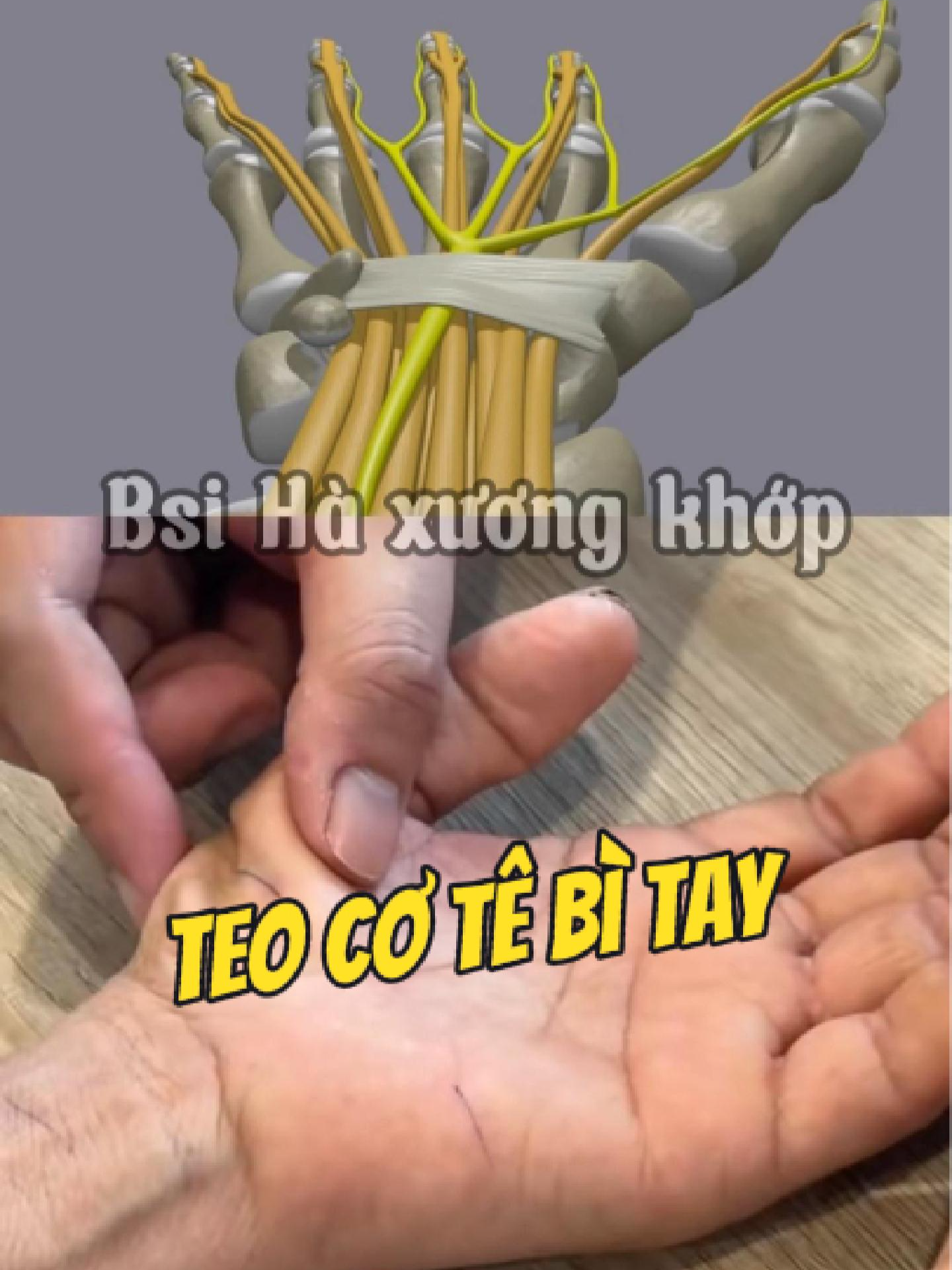 @Chuy&ecirc;n gia xương khớp