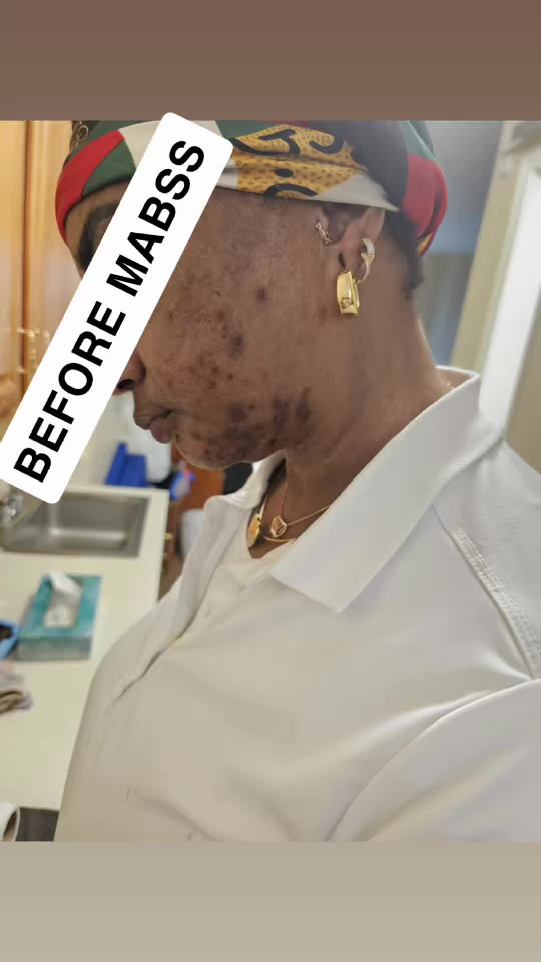 @MABSS SKINCARE