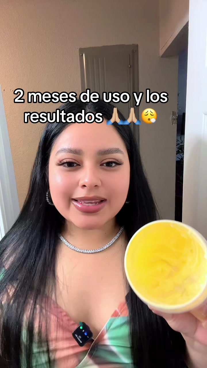 @alexa9