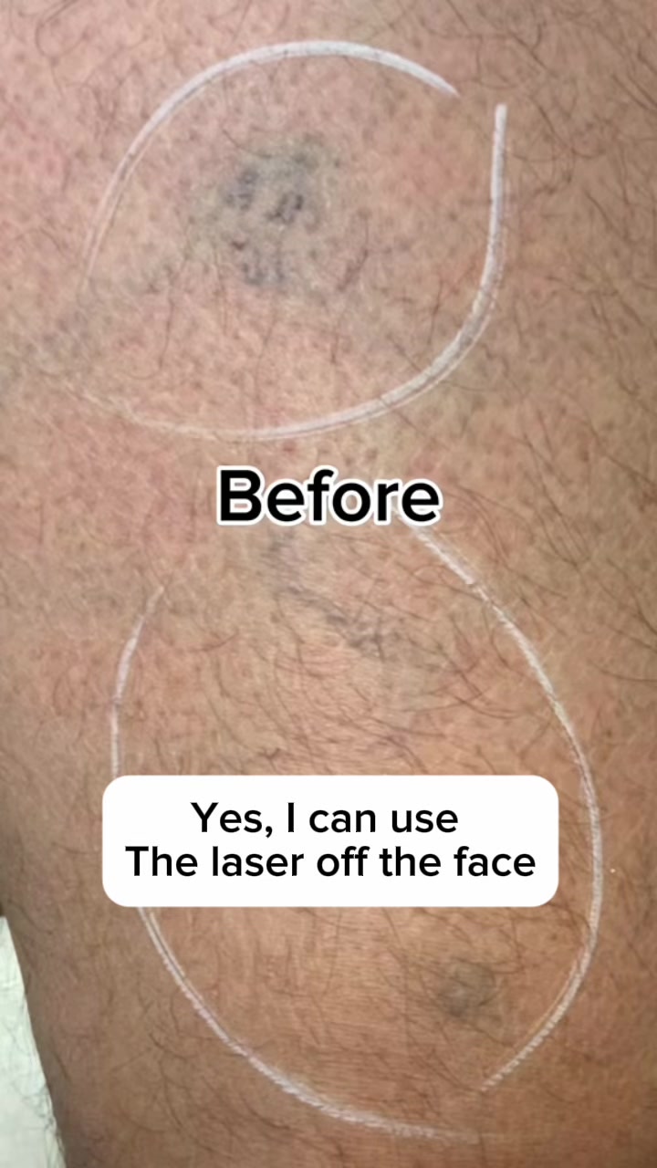 @Rosedermnyc