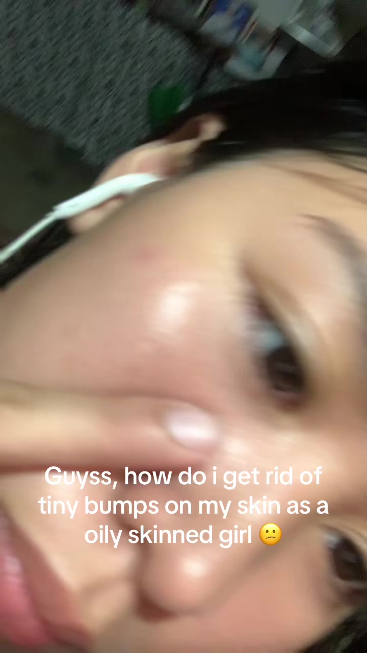 @Renee