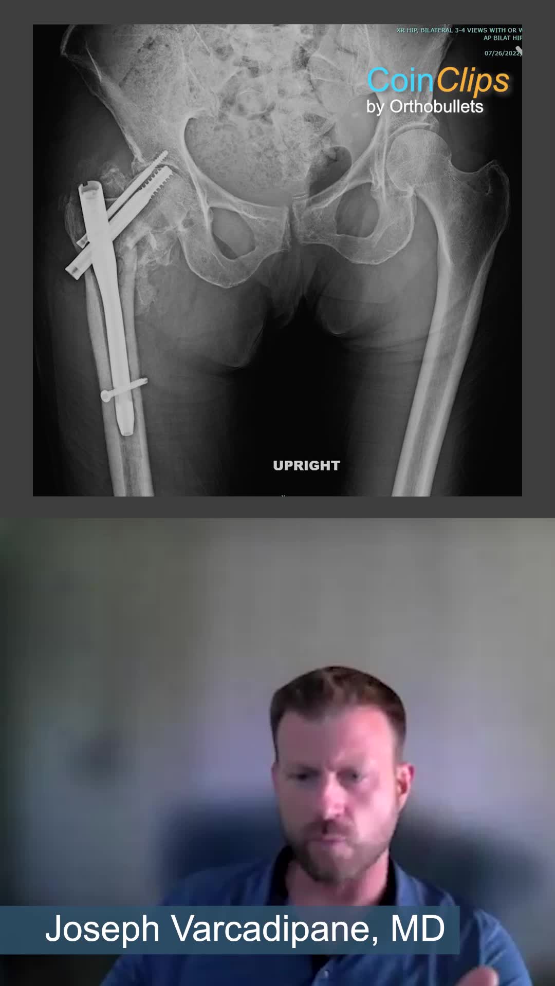 @Orthobullets