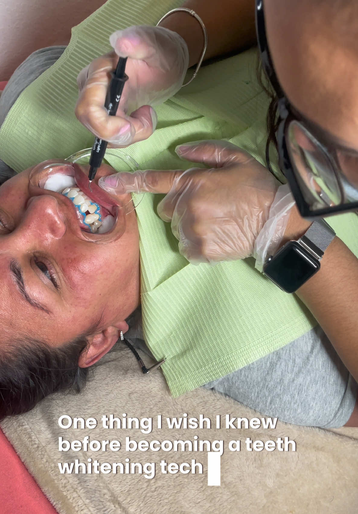 @Diandra | Teeth Whitening Tech