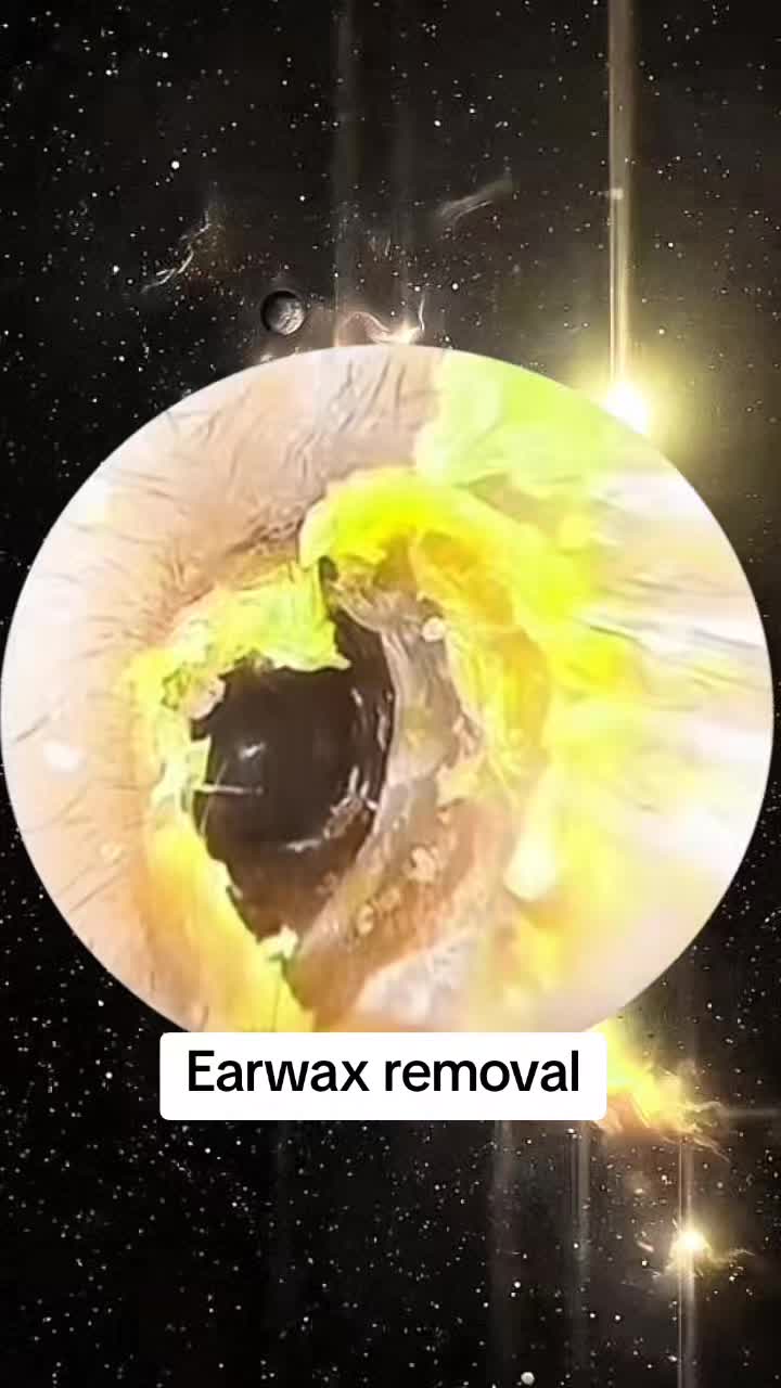 @Earwax.pro