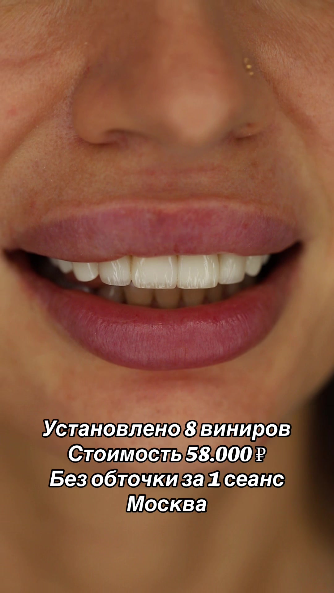 @Royal_smile_moscow