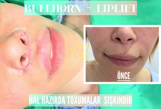@Dr.Zamanov_Cemil