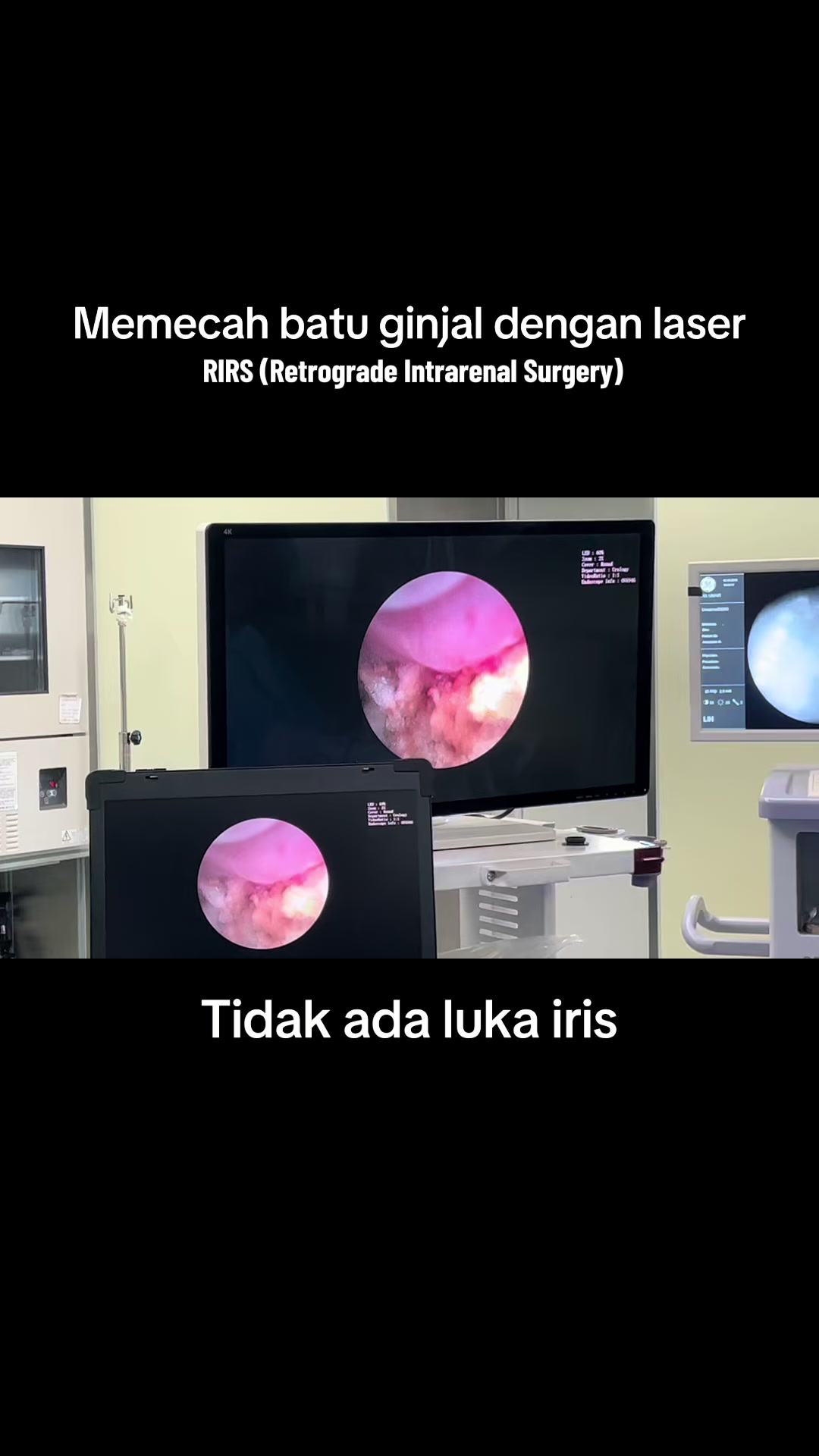 @Hantu OK