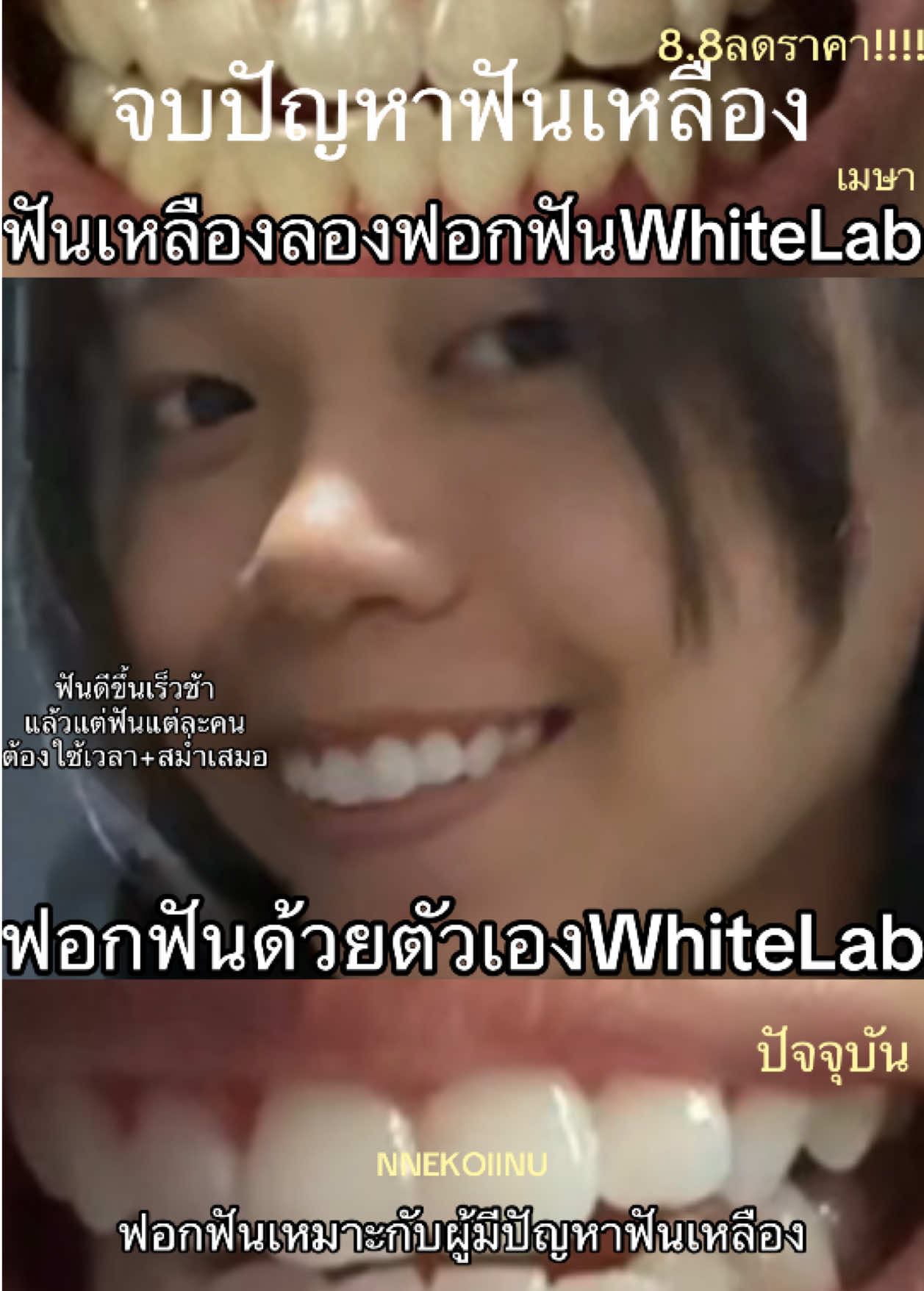 @NNEkOIINUใช้แล้วดี