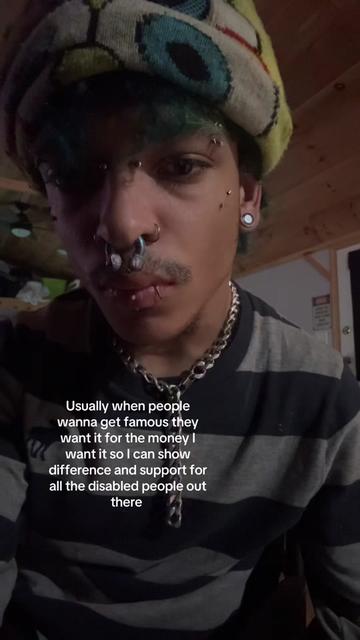 @Alt prince 🧑🏽🦽➡️