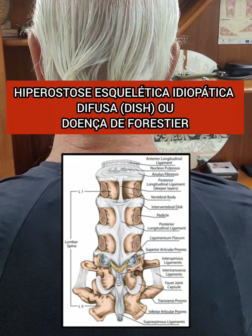 @Jo&atilde;o Miguel ASJ