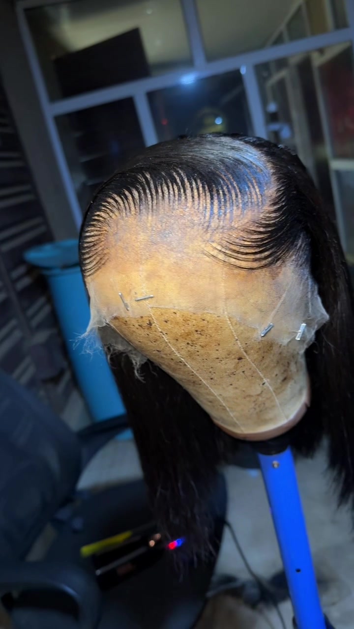 @Williams hairline