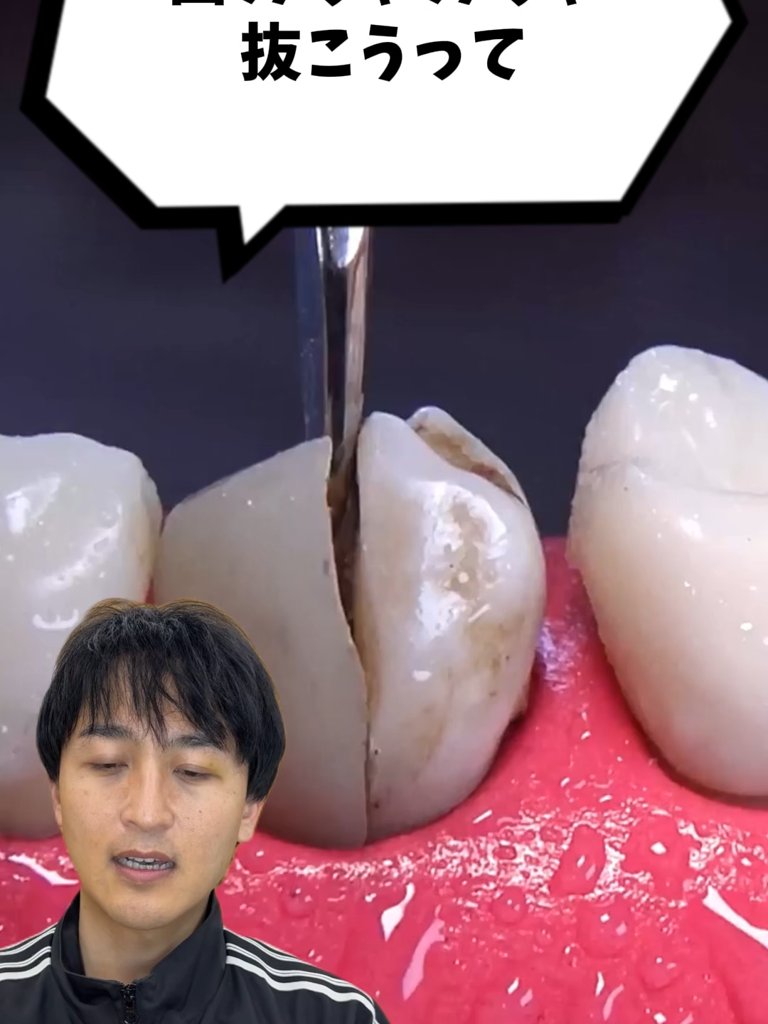 @金歯先生☆歯医者