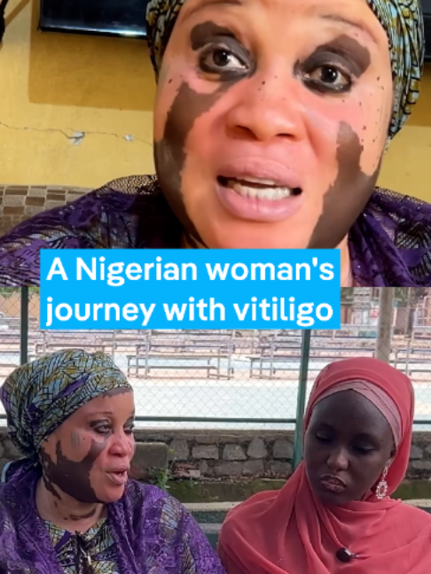 @DW Africa