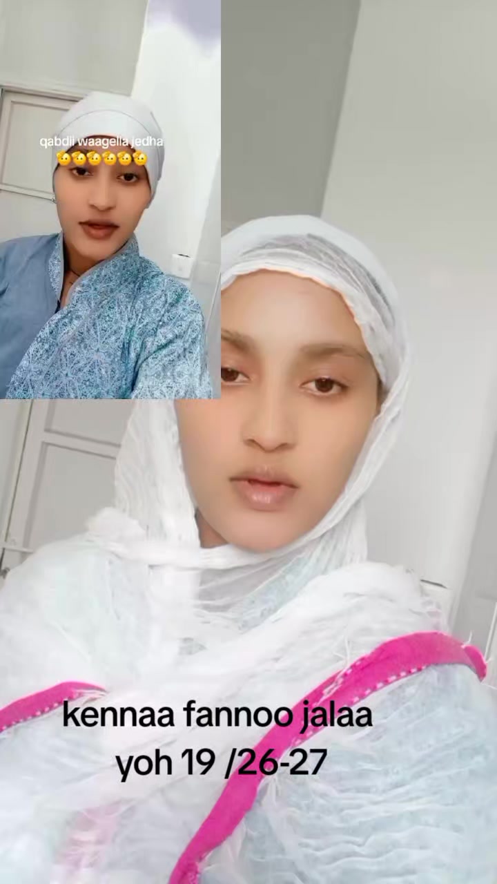 @Bikiltu 21