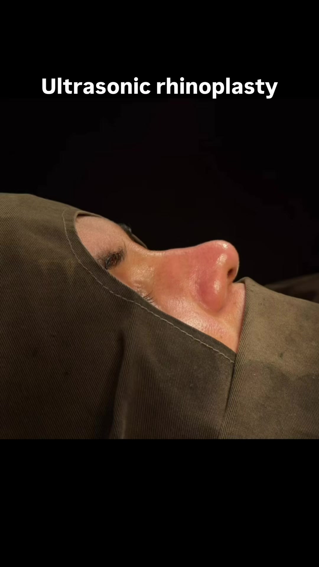@Dr Ibrar ENT & Rhinoplasty