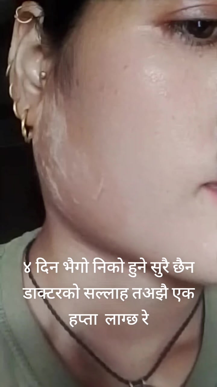 @Ritesh Babu