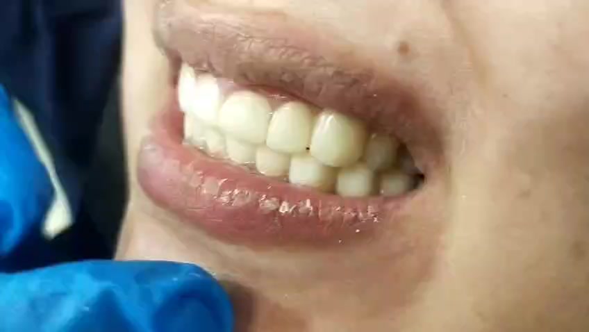 @Dr Adil khan 🦷🦷