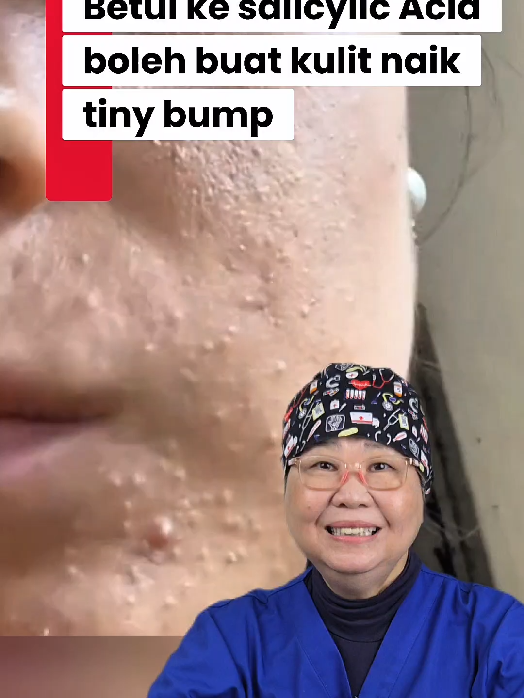 @Nora Mun | Tips Kesihatan