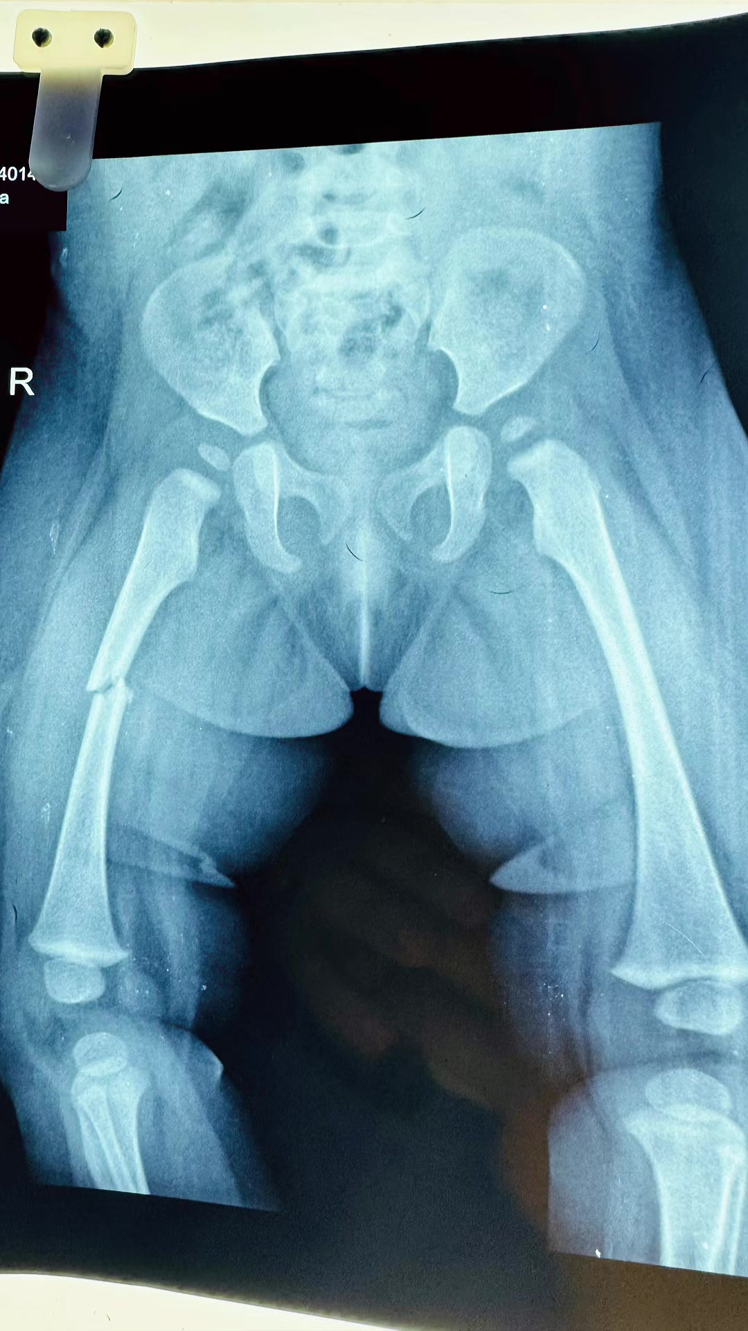 @Dr.Sanjay Gautam,Orthopedics🦴