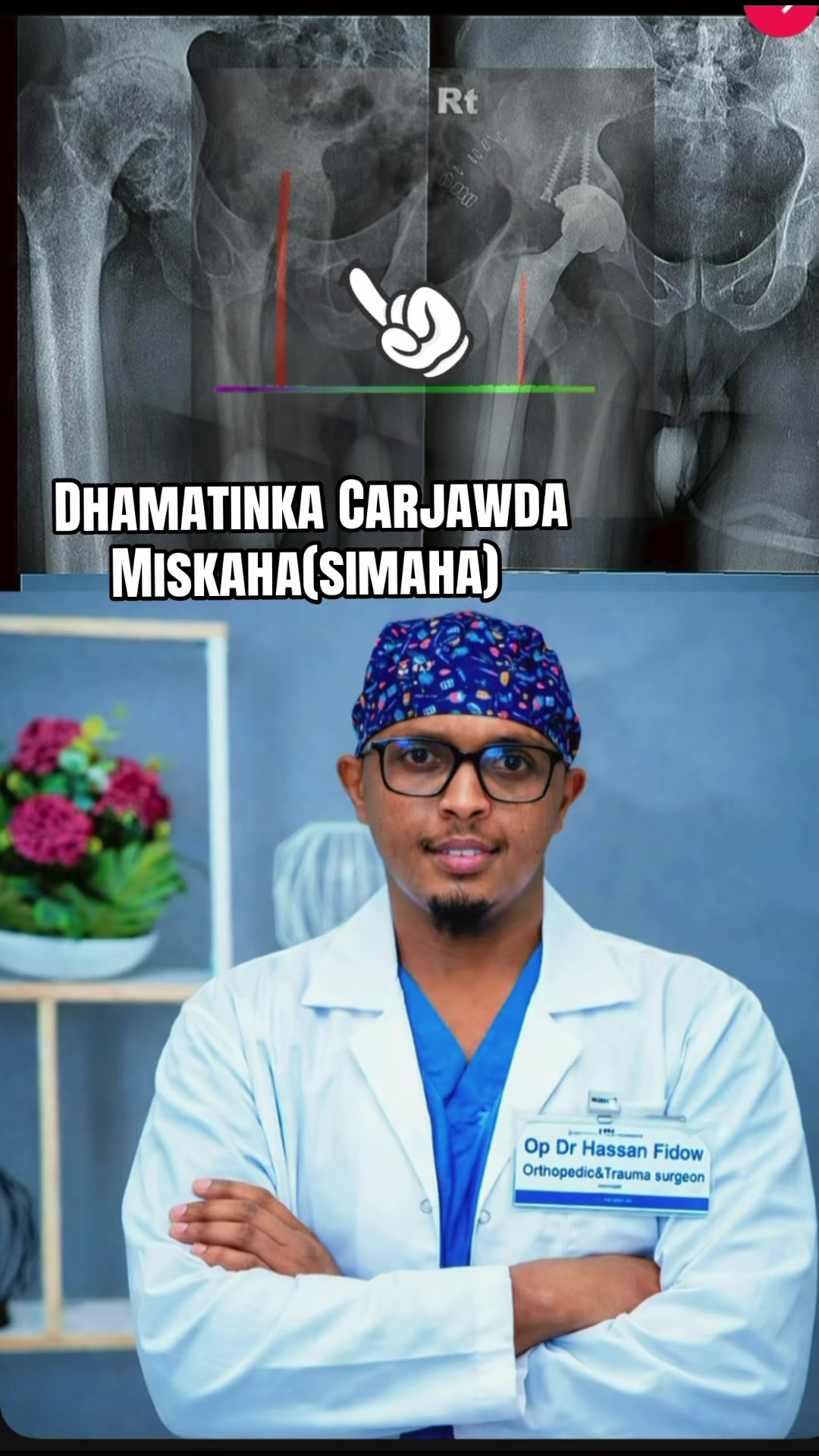 @DrHassan Fidow