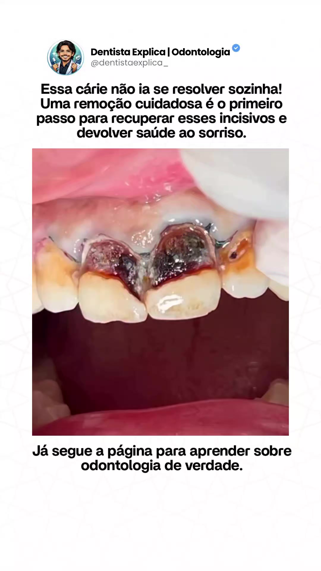 @Dentista Explica | Odontologia