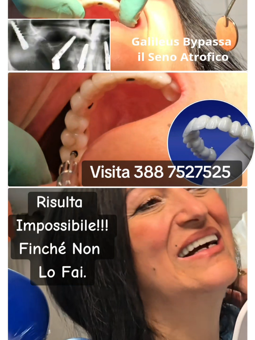 @Implantologiaprezzi