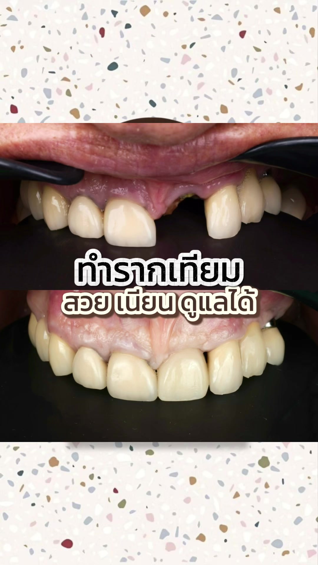 @smile Art Pattaya