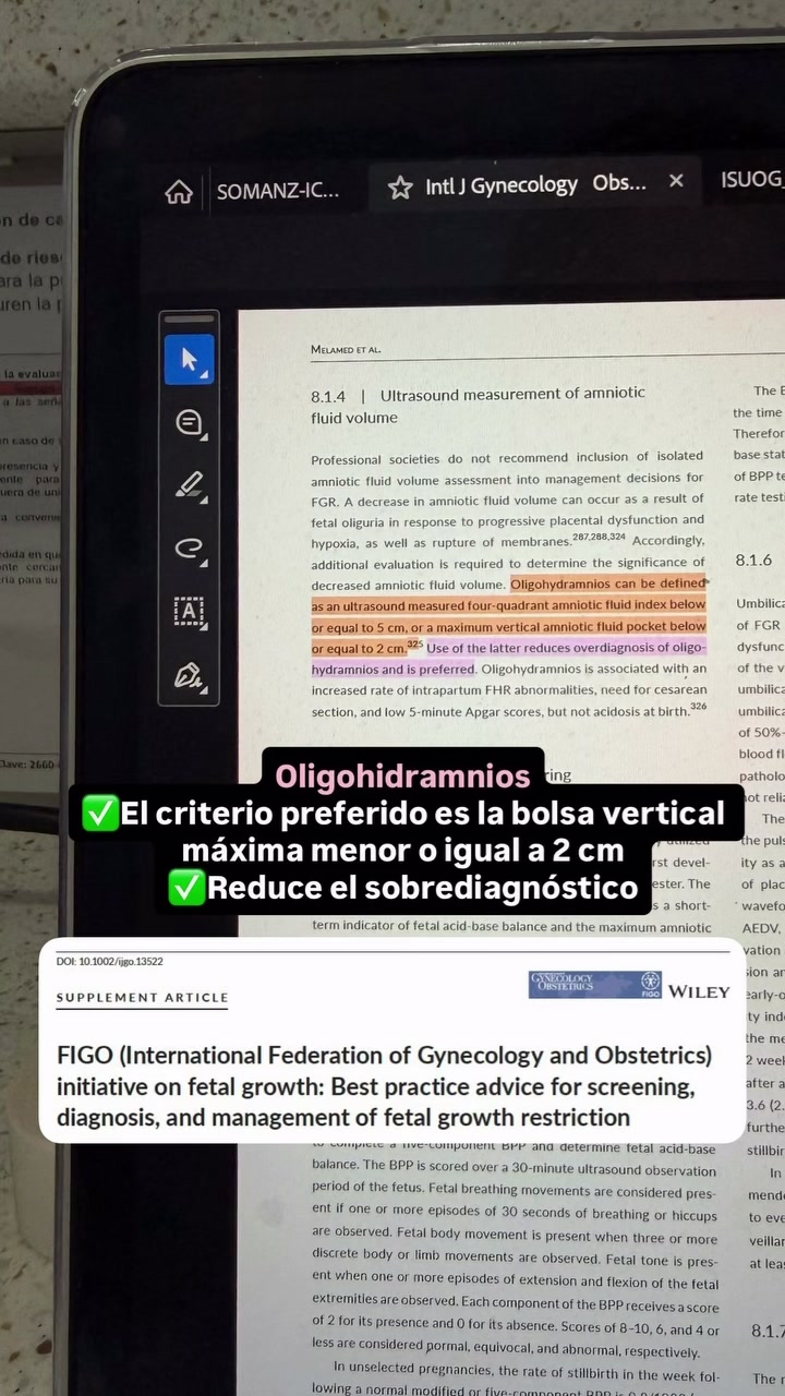 @ferlegarra