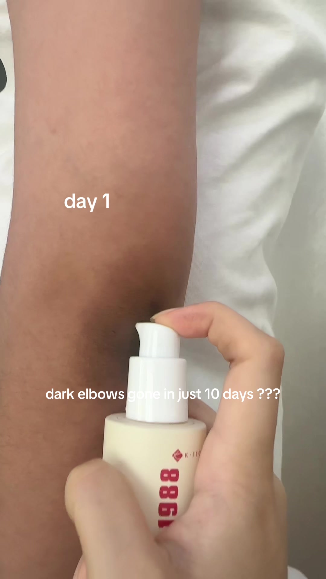 @Elinna
