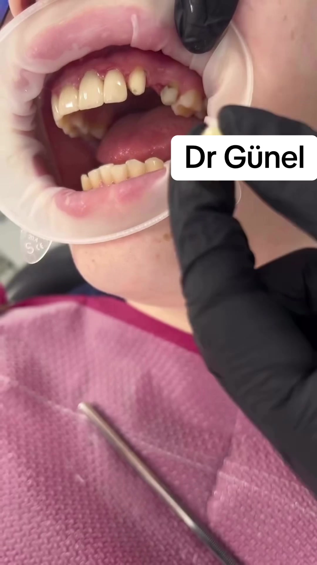 @Dentist_G&uuml;nel