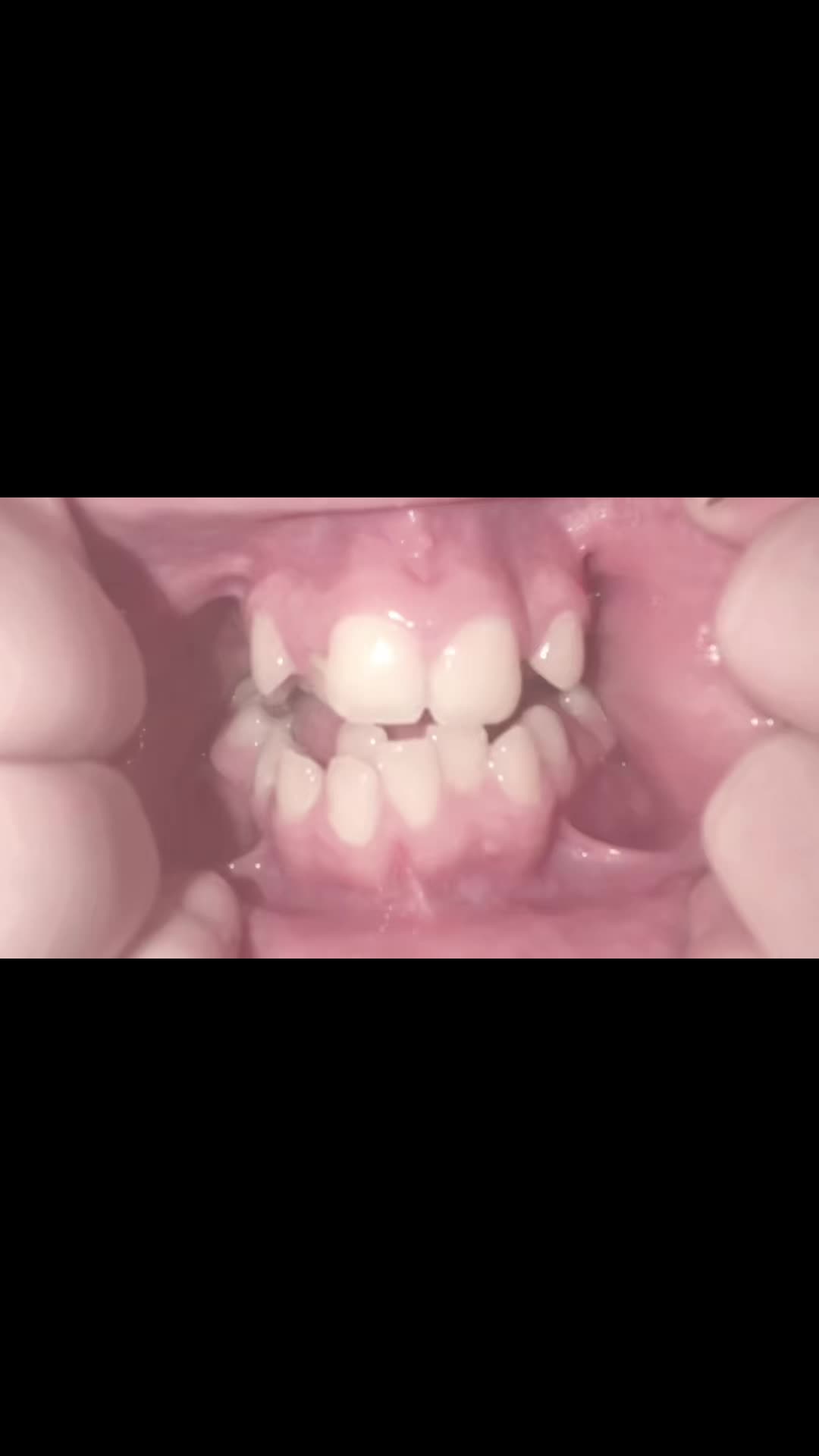 @𝐻𝒶𝓊𝓃𝓉𝑒𝒹