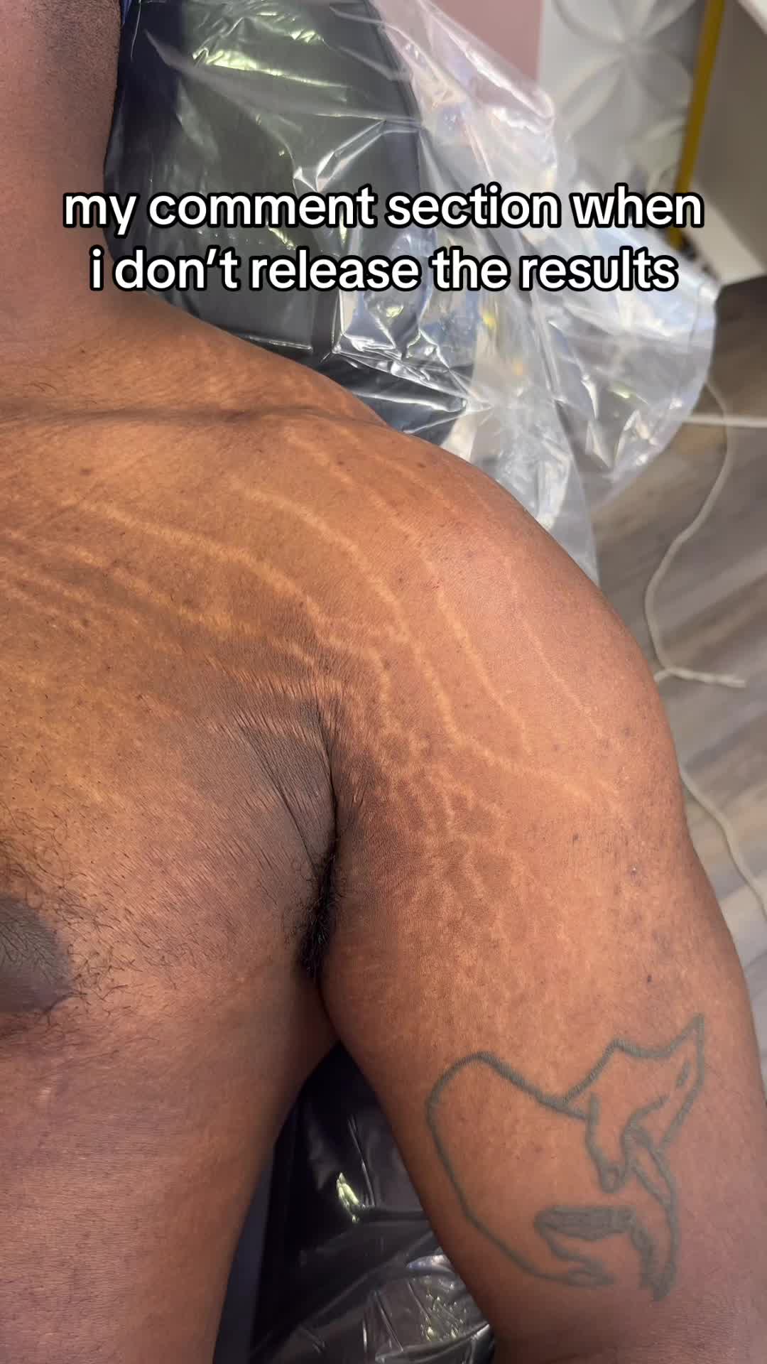 @Stretch Mark Fairy 🧚✨
