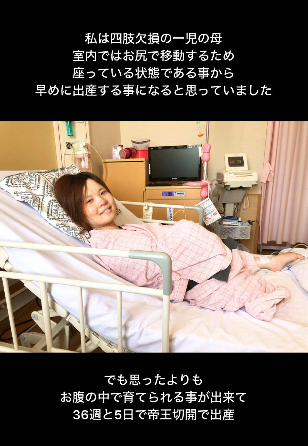 @佐野有美/講演家•四肢欠損ママ