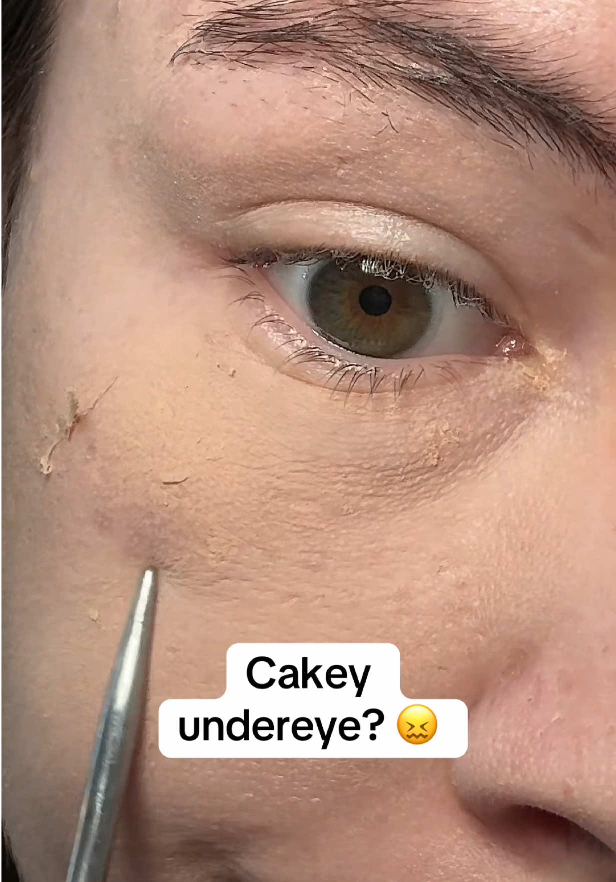 @watermelonsugarskin