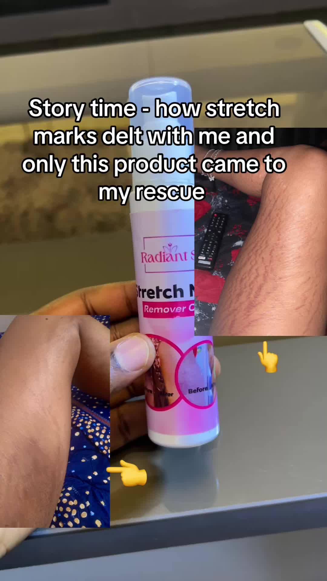 @Radiant skin