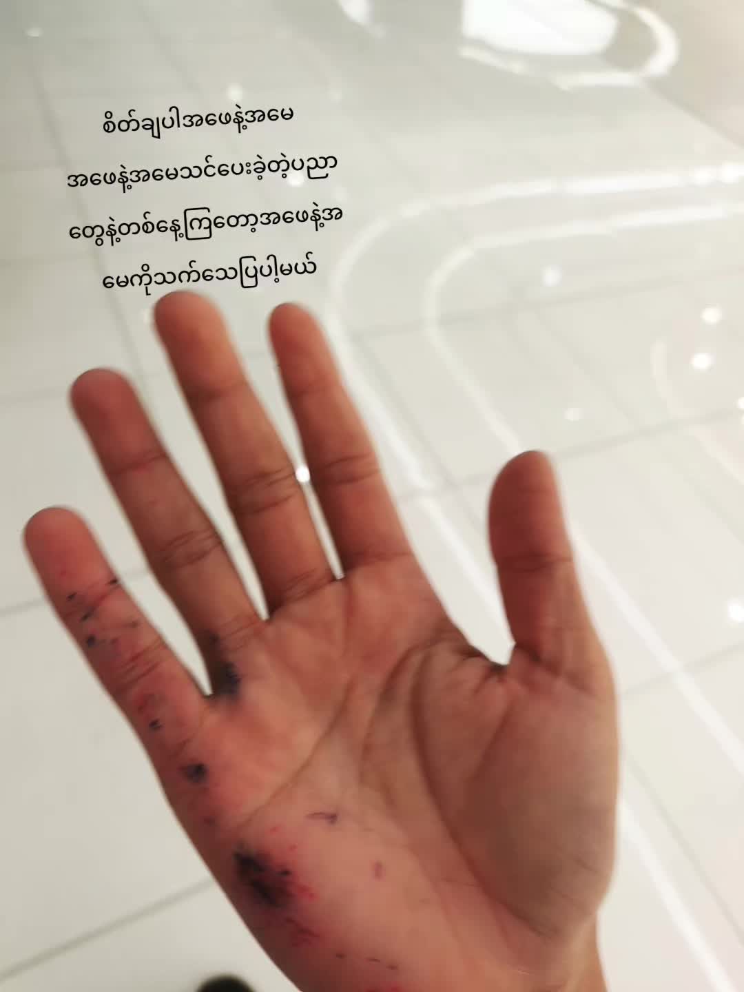 @အိပ်ချင်မူးတူးဘုရင်မလေး🤒🥱