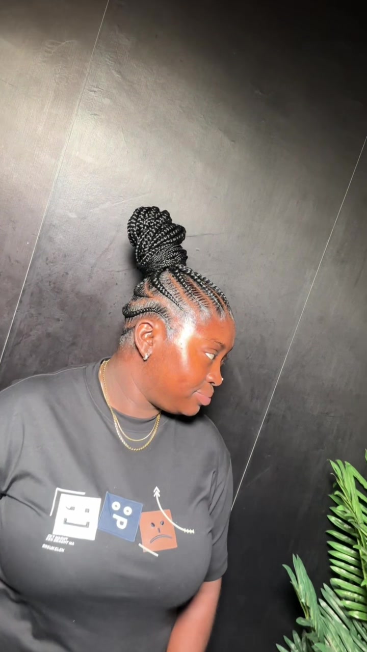 @Pemisire hairline