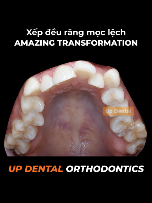 @Nha khoa niềng răng Up Dental